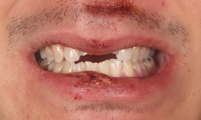 Before (dental trauma)